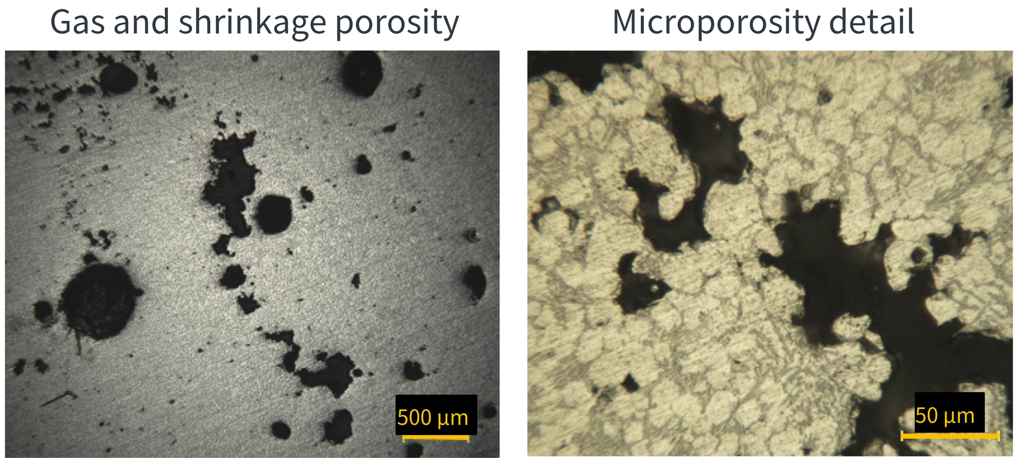 Optical micrographs of an AlSi9Cu3(Fe) aluminum die casting: gas and shrinkage porosity coexist on the left; microporosity detail on the right